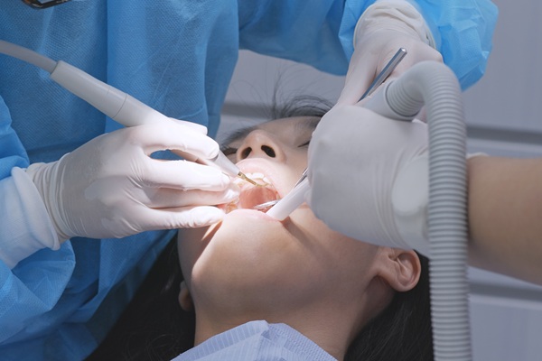 Deep Teeth Cleanings: What They Are And What To Expect