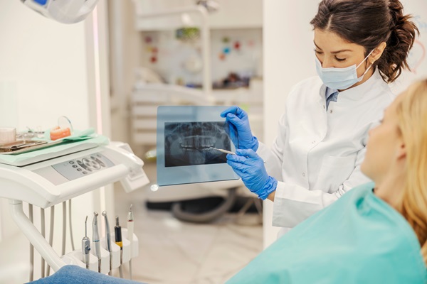 General Dentistry: How A Dentist Uses X Rays In A Dental Exam