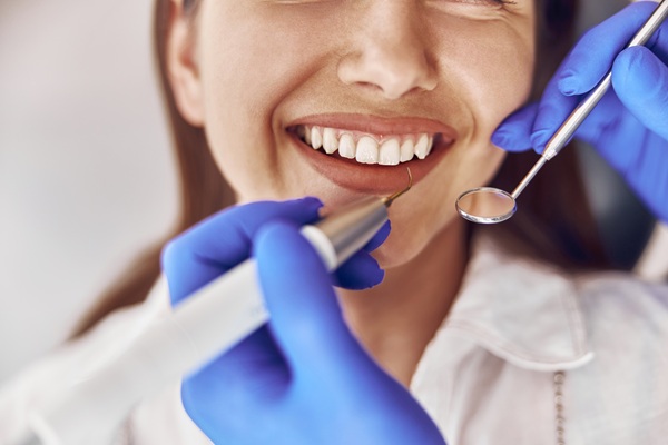 How Does In Office Professional Teeth Whitening Work?