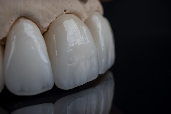 Dental Restoration    : An Overview Of Zirconia Crowns
